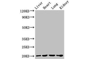 Western Blot Positive WB detected in: Rat liver tissue, Mouse heart tissue, Mouse lung tissue, Mouse kidney tissue All lanes: GPIHBP1 antibody at 4 μg/mL Secondary Goat polyclonal to rabbit IgG at 1/50000 dilution Predicted band size: 20 kDa Observed band size: 20 kDa (GPIHBP1 抗体  (AA 21-151))