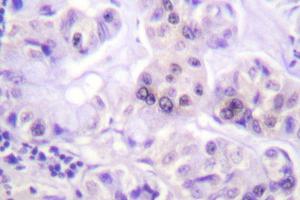 Image no. 1 for anti-Parkinson Protein 2, E3 Ubiquitin Protein Ligase (Parkin) (PARK2) antibody (ABIN271936) (Parkin 抗体)