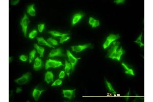 Immunofluorescence of monoclonal antibody to EEF1G on HeLa cell. (EEF1G 抗体  (AA 1-437))