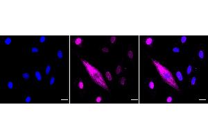 anti-Keratin 4 (KRT4) antibody