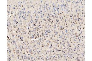 IHC analysis of PMPCA/INPP5 using anti-PMPCA/INPP5 antibody (ABIN7602722). (PMPCA 抗体  (AA 99-525))