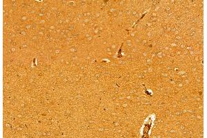 ABIN6263901 and ABIN6278065 at 1/100 staining Mouse brain tissue by IHC-P. (ORAI1 抗体  (C-Term))