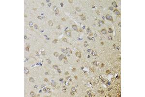 Immunohistochemistry of paraffin-embedded rat brain using CHN1 antibody (ABIN5974737) at dilution of 1/100 (40x lens). (CHN1 抗体)