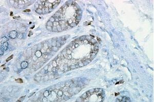 Immunohistochemistry (IHC) image for anti-Heat Shock Protein 90 (HSP90) antibody (PerCP) (ABIN2481356)