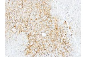 IHC-P Image Immunohistochemical analysis of paraffin-embedded AGS xenograft, using BSEP, antibody at 1:100 dilution.