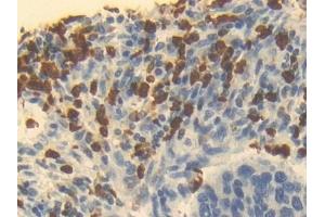 Immunohistochemistry (IHC) image for anti-Ornithine Carbamoyltransferase (OTC) (AA 78-129) antibody (ABIN7433690)