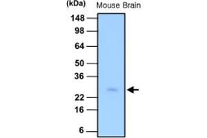 Western blot analysis of tissue lysate of mouse brain (30 ug) was resolved by SDS - PAGE , transferred to PVDF membrane and probed with PSPH monoclonal antibody , clone 3G12 (1 : 1000) . (PSPH 抗体)