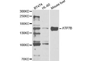Western blot analysis of extracts of various cell lines, using ATP7B antibody. (ATP7B 抗体)