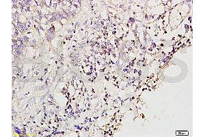 Formalin-fixed and paraffin embedded rat brain tissue labeled with Anti-MGMT Polyclonal Antibody (ABIN730768), Unconjugated at 1:200 followed by conjugation to the secondary antibody and DAB staining (MGMT 抗体  (AA 101-207))