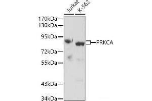 Western blot analysis of extracts of various cell lines using PRKCA Polyclonal Antibody. (PKC alpha 抗体)