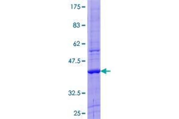 ZNF544 Protein (AA 1-106) (GST tag)