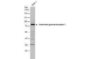 WB Image Interferon gamma Receptor 1 antibody detects Interferon gamma Receptor 1 protein by western blot analysis. (IFNGR1 抗体)