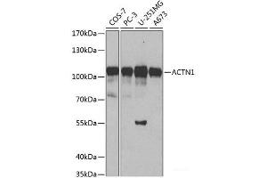 ACTN1 抗体