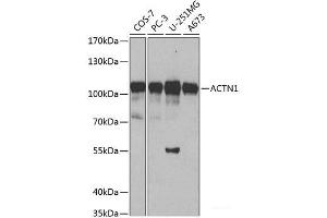 Western blot analysis of extracts of various cell lines using ACTN1 Polyclonal Antibody at dilution of 1:500. (ACTN1 抗体)