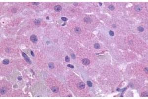 Immunohistochemical (Formalin/PFA-fixed paraffin-embedded sections) staining in human ovary with PTGFR polyclonal antibody . (PTGFR 抗体  (2nd Extracellular Domain))