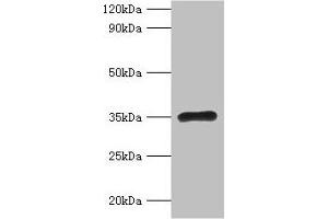 Western blot All lanes: RPL5 antibody at 2 μg/mL + EC109 whole cell lysate Secondary Goat polyclonal to rabbit IgG at 1/15000 dilution Predicted band size: 35 kDa Observed band size: 35 kDa (RPL5 抗体  (AA 2-297))