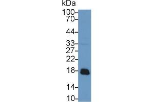 Western blot analysis of Rat Liver lysate, using Rabbit Anti-Rat ACP1 Antibody (1 µg/ml) and HRP-conjugated Goat Anti-Rabbit antibody (abx400043, 0. (ACP1 抗体  (AA 1-158))