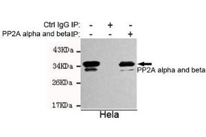 Immunoprecipitation analysis of Hela cell lysates using A alpha and beta mouse mAb. (PP2A alpha/beta 抗体)
