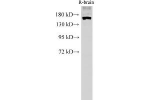 Western Blot analysis of Rat brain tissue using PARD3A Polyclonal Antibody at dilution of 1:500 (PARD3 抗体)