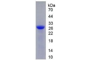 Image no. 1 for Deoxyribonuclease I (DNASE1) (AA 19-259) (Active) protein (His tag) (ABIN6239898) (DNASE1 Protein (AA 19-259) (His tag))