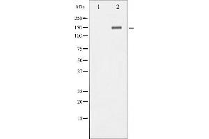 Western Blotting (WB) image for anti-Neurotrophic Tyrosine Kinase, Receptor, Type 2 (NTRK2) (pTyr706) antibody (ABIN6255997)