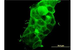 Immunofluorescence of monoclonal antibody to PDLIM5 on A-431 cell. (PDLIM5 抗体  (AA 1-596))