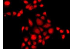 Immunofluorescence analysis of A549 cells using MLF1 Polyclonal Antibody (MLF1 抗体)