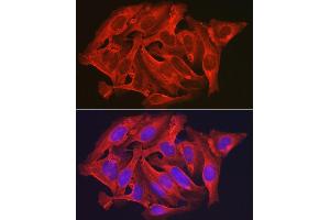 Immunofluorescence analysis of U2OS cells using D Rabbit pAb (ABIN6134076, ABIN6139403, ABIN6139404 and ABIN6224222) at dilution of 1:250 (40x lens). (DAPK2 抗体  (C-Term))