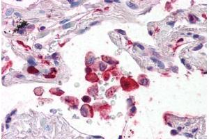 Human Lung (formalin-fixed, paraffin-embedded) stained with AIF1 antibody ABIN337364 at 5 ug/ml followed by biotinylated anti-goat IgG secondary antibody ABIN481715, alkaline phosphatase-streptavidin and chromogen. (Iba1 抗体  (AA 149-161))