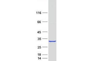 Western Blotting (WB) image for Myosin Light Chain 4, Alkali, Atrial, Embryonic (MYL4) (Transcript Variant 2) protein (Myc-DYKDDDDK Tag) (ABIN2726670)