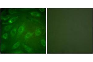 Immunofluorescence analysis of NIH-3T3 cells, using Collagen I Antibody. (Collagen Type I 抗体  (AA 1-50))