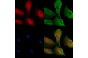 ABIN6261039 and ABIN6278845 staining  cells by IF/ICC.