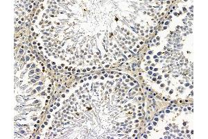 ABIN7096614 and ABIN7100678 at 1/100 staining rat testis tissue by IHC-P. (MON1A 抗体)