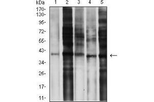 Western Blotting (WB) image for anti-Chemokine (C-C Motif) Receptor 5 (CCR5) antibody (ABIN5611203)