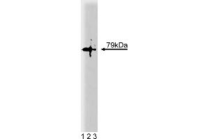 Western Blotting (WB) image for anti-Protein Kinase C, theta (PRKCQ) (AA 21-217) antibody (ABIN967739) (PKC theta 抗体  (AA 21-217))