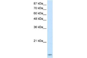 WB Suggested Anti-TARBP2 Antibody Titration:  2. (TARBP2 抗体  (N-Term))