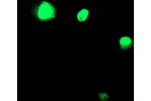 Image no. 3 for anti-T-Cell Acute Lymphocytic Leukemia 1 (TAL1) antibody (ABIN1501292)