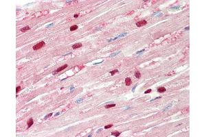 Human, Heart: Formalin-Fixed Paraffin-Embedded (FFPE). (TPI1 抗体  (N-Term))