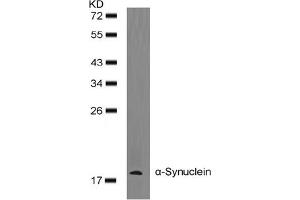 Image no. 2 for anti-Synuclein, alpha (SNCA) (AA 131-135) antibody (ABIN401570) (SNCA 抗体  (AA 131-135))