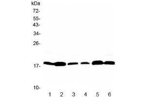 Western blot testing of rat 1) brain, 2) heart, 3) kidney and moouse 4) brain, 5) heart, 6) kidney with MED9 antibody at 0. (MED9 抗体)
