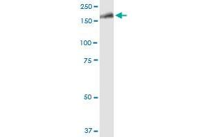 LRRK1 MaxPab polyclonal antibody. (LRRK1 抗体  (AA 1-261))