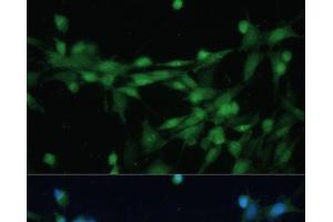 Immunofluorescence analysis of NIH-3T3 cells using CSNK2B Polyclonal Antibody at dilution of 1:100 (40x lens). (CSNK2B 抗体)