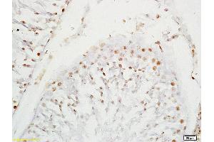 Formalin-fixed and paraffin embedded rat testis labeled with Anti-SOX9/SRA1 Polyclonal Antibody, Unconjugated (ABIN754963) at 1:200 followed by conjugation to the secondary antibody and DAB staining (SOX9 抗体  (AA 121-220))