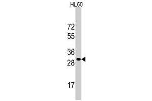 Western blot analysis of RPS6 polyclonal antibody  in HL-60 cell line lysates (35 ug/lane). (RPS6 抗体  (N-Term))