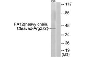 Western blot analysis of extracts from 293 cells, treated with etoposide 25uM 1h, using FA12 (heavy chain,Cleaved-Arg372) Antibody. (F12 抗体  (Cleaved-Arg372))