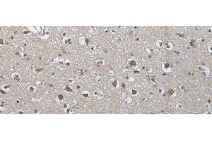Immunohistochemistry of paraffin-embedded Human brain tissue using USP35 Polyclonal Antibody at dilution of 1:55(x200) (USP35 抗体)