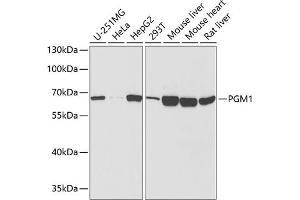 Western blot analysis of extracts of various cell lines, using PGM1 antibody  at 1:1000 dilution. (Phosphoglucomutase 1 抗体  (AA 1-300))