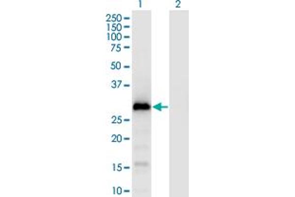 G Antigen 1 antibody  (AA 1-139)