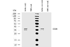 Western blotting analysis of human CD28 using mouse monoclonal antibody CD28. (CD28 抗体)