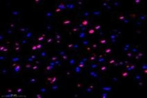 Immunofluorescent analysis of paraformaldehyde-fixed rat hippocampus using MED3 (ABIN7074581) at dilution of 1: 1000 (MED27 抗体)